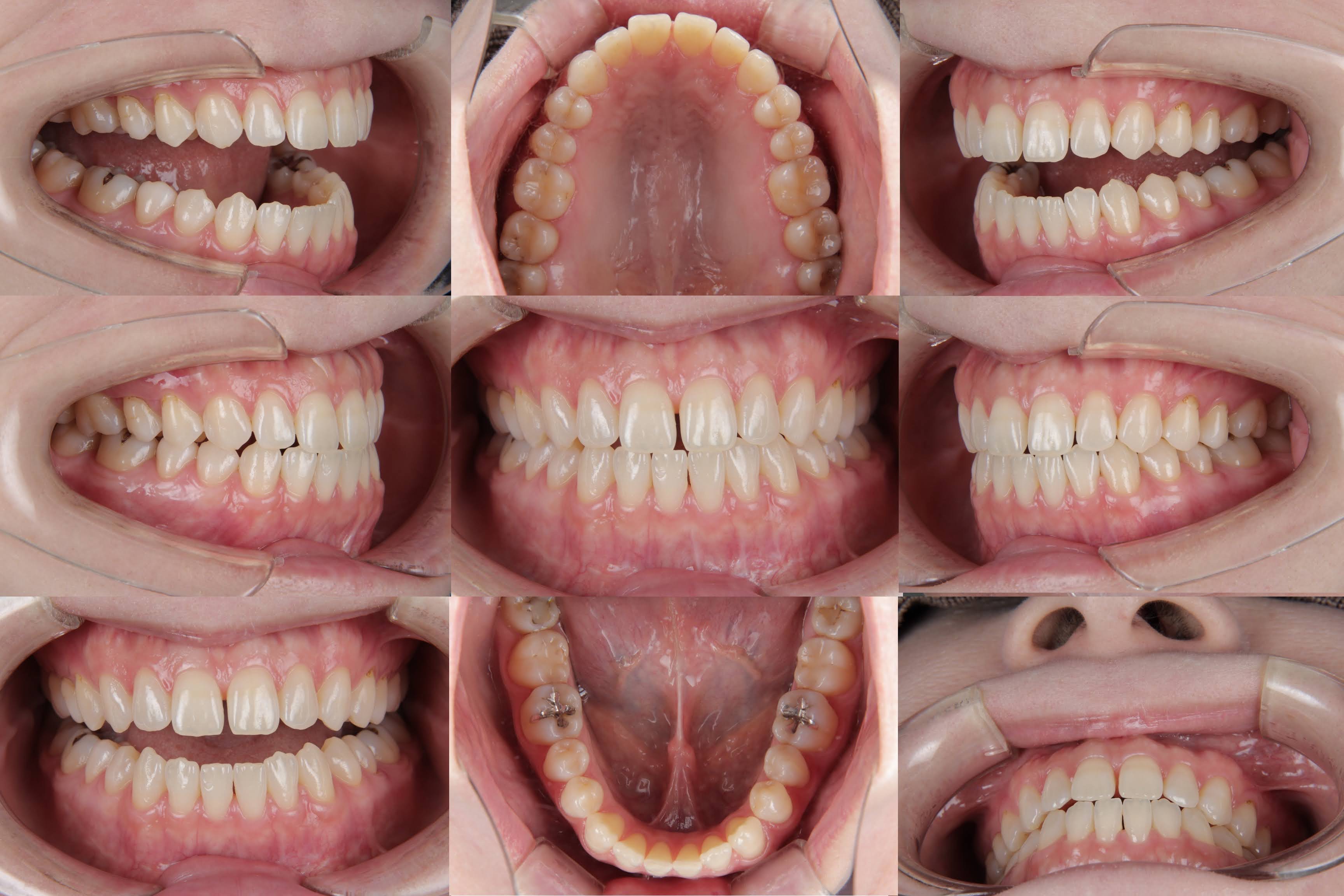 ORAL PHOTOGRAPHY | 歯科医師目線の口腔内写真カメラ紹介サイト